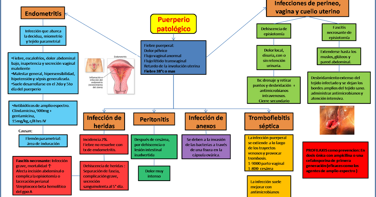 Estreñimiento con dolor abdominal bajo